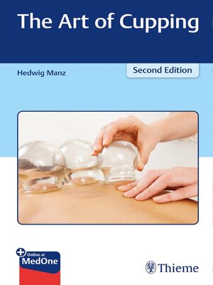 cover image of The Art of Cupping